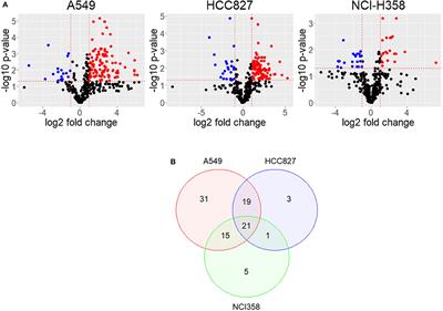 Analysis of Epithelial-Mesenchymal Transition Metabolism Identifies Possible Cancer Biomarkers Useful in Diverse Genetic Backgrounds